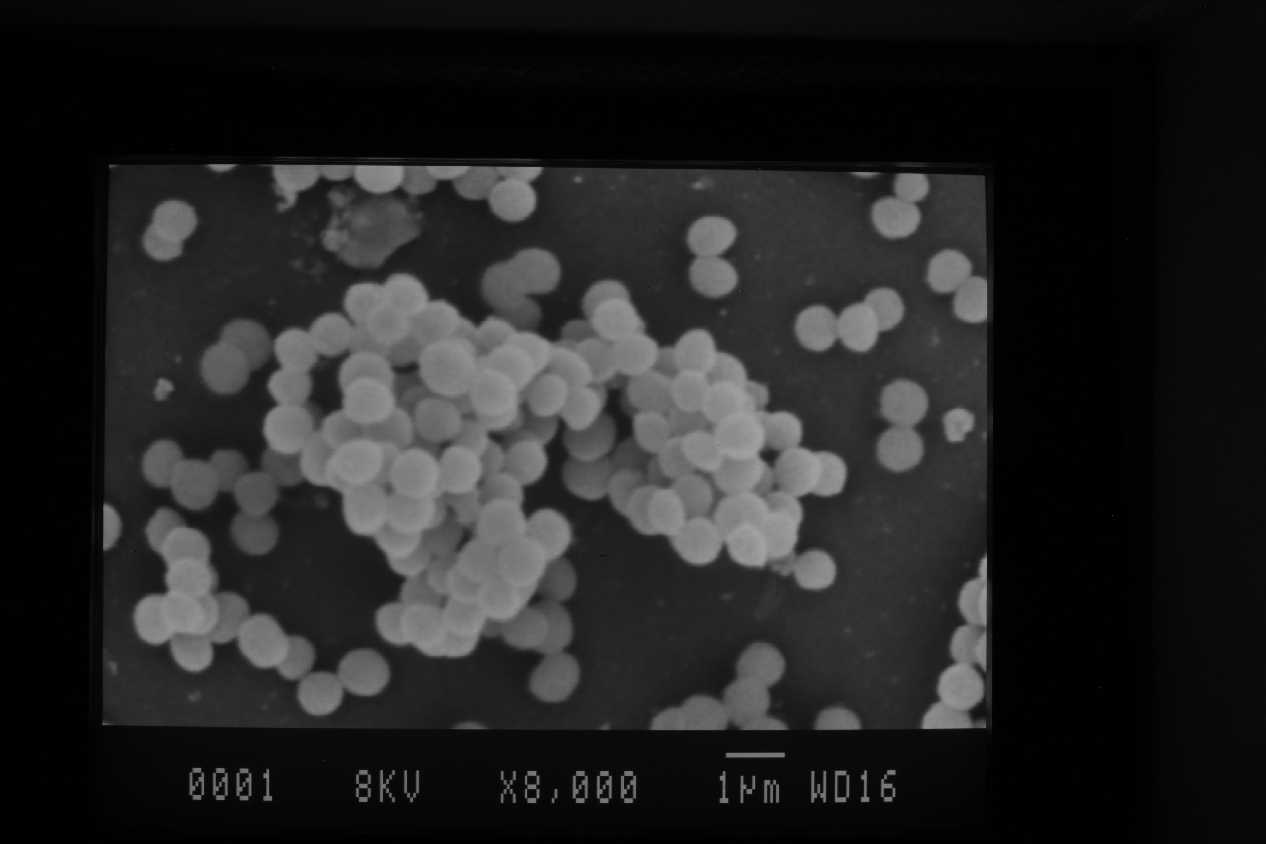 استافیلوکوکوس اورئوس با میکروسکوپ الکترونی